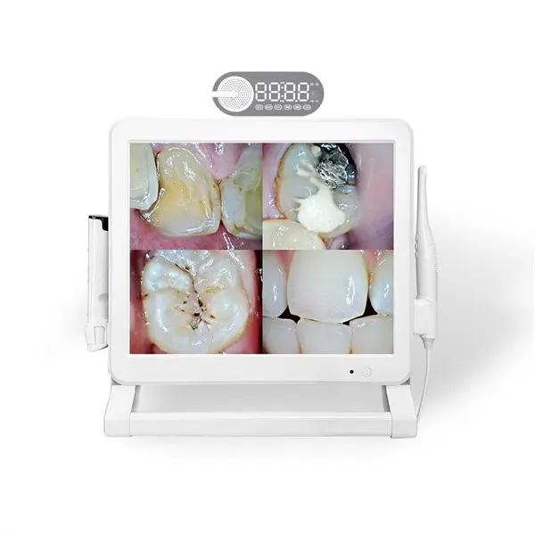 Identify dental issues with precision and effectiveness using our state-of-the-art teeth camera.