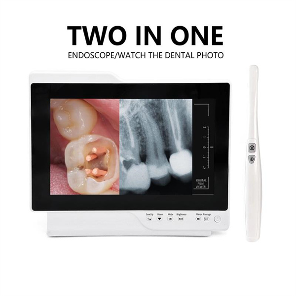 Improve treatment outcomes and accuracy with our cutting-edge dental camera