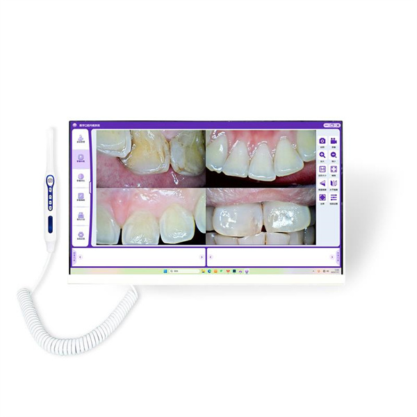 Get superior quality imaging at an affordable price with our teeth camera.
