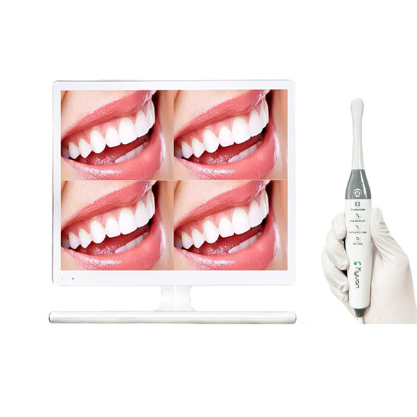 Say goodbye to uncomfortable mirrors and say hello to the clarity of an intraoral camera